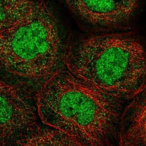 Anti-ANKRD11 antibody produced in rabbit 