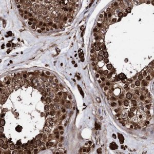 Anti-ANKRD12 antibody produced in rabbit 