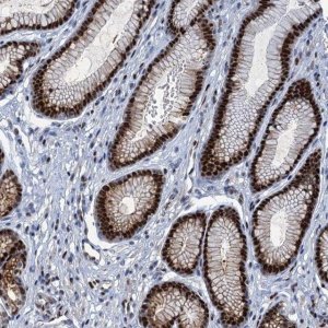 Anti-ANKRD13D antibody produced in rabbit 