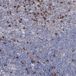 Anti-ANKRD16 antibody produced in rabbit 
