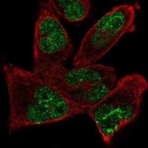 Anti-ANKRD17 antibody produced in rabbit 