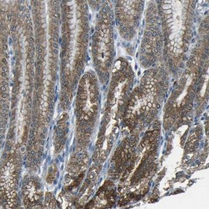 Anti-ANKRD22 antibody produced in rabbit 