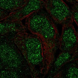 Anti-ANKRD22 antibody produced in rabbit 