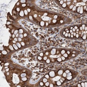 Anti-ANKRD26 antibody produced in rabbit 