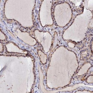 Anti-ANKRD27 antibody produced in rabbit 
