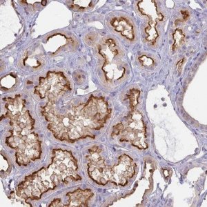 Anti-ANKRD33 antibody produced in rabbit 