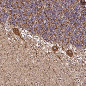 Anti-ANKRD33B antibody produced in rabbit 