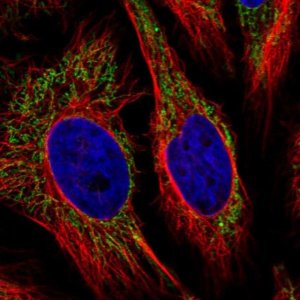 Anti-ANKRD33B antibody produced in rabbit 