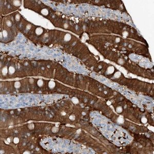 Anti-ANKRD34A antibody produced in rabbit 
