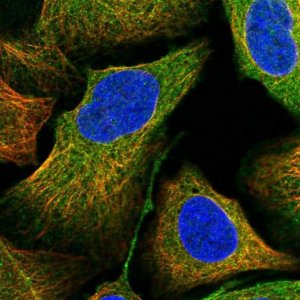 Anti-ANKRD34A antibody produced in rabbit 