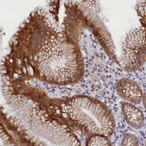 Anti-ANKRD34B antibody produced in rabbit 