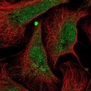 Anti-ANKRD34B antibody produced in rabbit 
