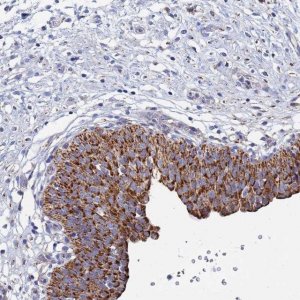 Anti-ANKRD34C antibody produced in rabbit 