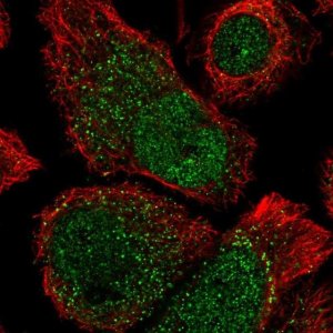 Anti-ANKRD37 antibody produced in rabbit 