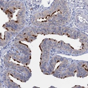 Anti-ANKRD42 antibody produced in rabbit 