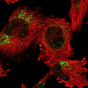 Anti-ANKRD44 antibody produced in rabbit 