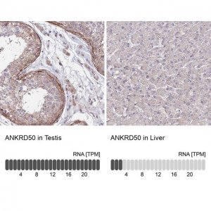 Anti-ANKRD50 antibody produced in rabbit 