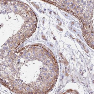 Anti-ANKRD50 antibody produced in rabbit 