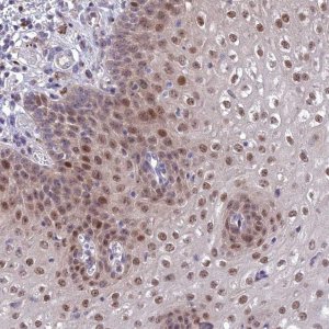 Anti-ANKRD52 antibody produced in rabbit 