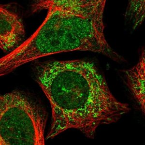 Anti-ANKRD52 antibody produced in rabbit 