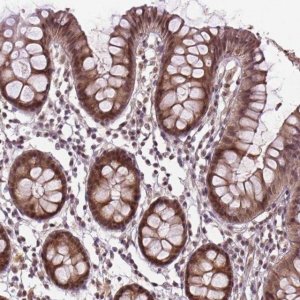 Anti-ANKRD54 antibody produced in rabbit 