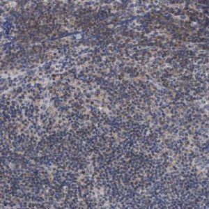 Anti-ANKRD55 antibody produced in rabbit 