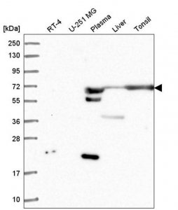 Anti-ANKRD55 antibody produced in rabbit 