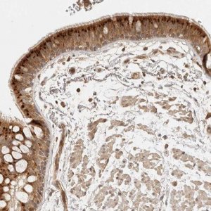Anti-ANKRD61 antibody produced in rabbit 