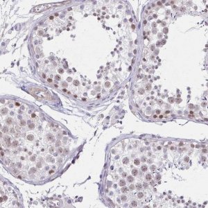 Anti-ANKRD62 antibody produced in rabbit 