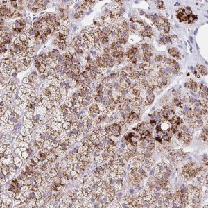 Anti-ANKRD9 antibody produced in rabbit 