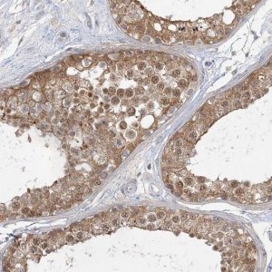 Anti-ANKS1A antibody produced in rabbit 