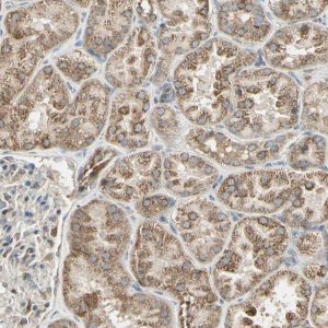 Anti-ANKS6 antibody produced in rabbit 