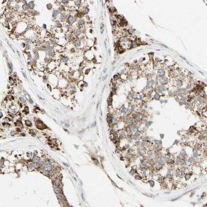 Anti-ANKS6 antibody produced in rabbit 