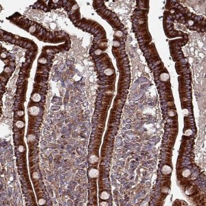 Anti-ANO10 antibody produced in rabbit 