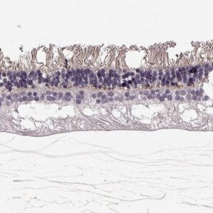 Anti-ANO2 antibody produced in rabbit 
