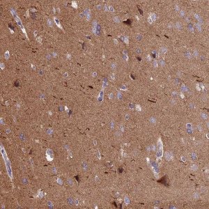 Anti-ANO3 antibody produced in rabbit 