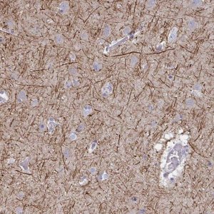 Anti-ANO5 antibody produced in rabbit 