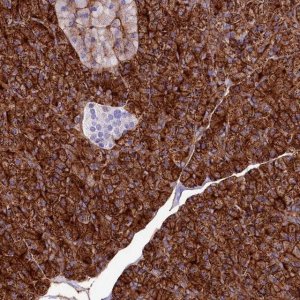 Anti-ANO6 antibody produced in rabbit 
