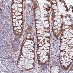 Anti-ANO8 antibody produced in rabbit 