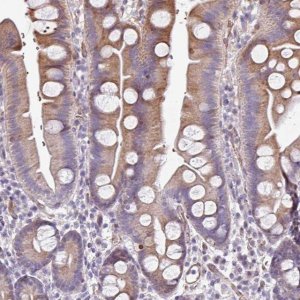 Anti-ANO9 antibody produced in rabbit 