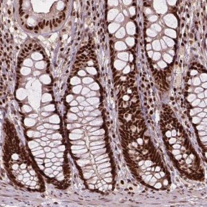 Anti-ANP32A antibody produced in rabbit HPA063133-100UL