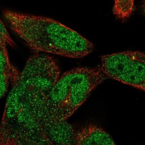 Anti-ANP32A antibody produced in rabbit HPA063133-100UL