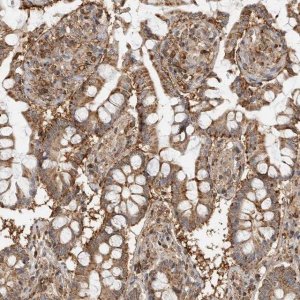 Anti-ANXA11 antibody produced in rabbit 