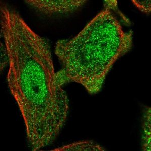 Anti-ANXA7 antibody produced in rabbit 