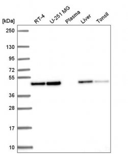 Anti-ANXA7 antibody produced in rabbit 