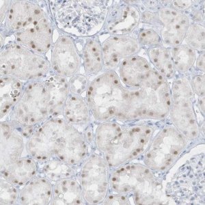 Anti-AP000322.53 antibody produced in rabbit 