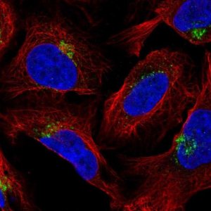 Anti-AP1AR antibody produced in rabbit 