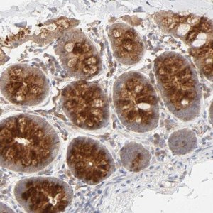 Anti-AP1G2 antibody produced in rabbit 