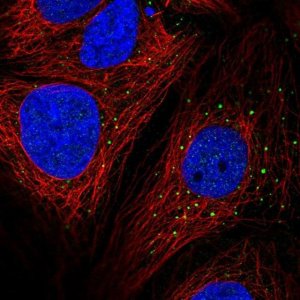 Anti-AP1M2 antibody produced in rabbit 