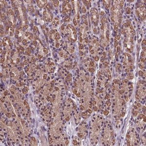 Anti-AP1S3 antibody produced in rabbit 